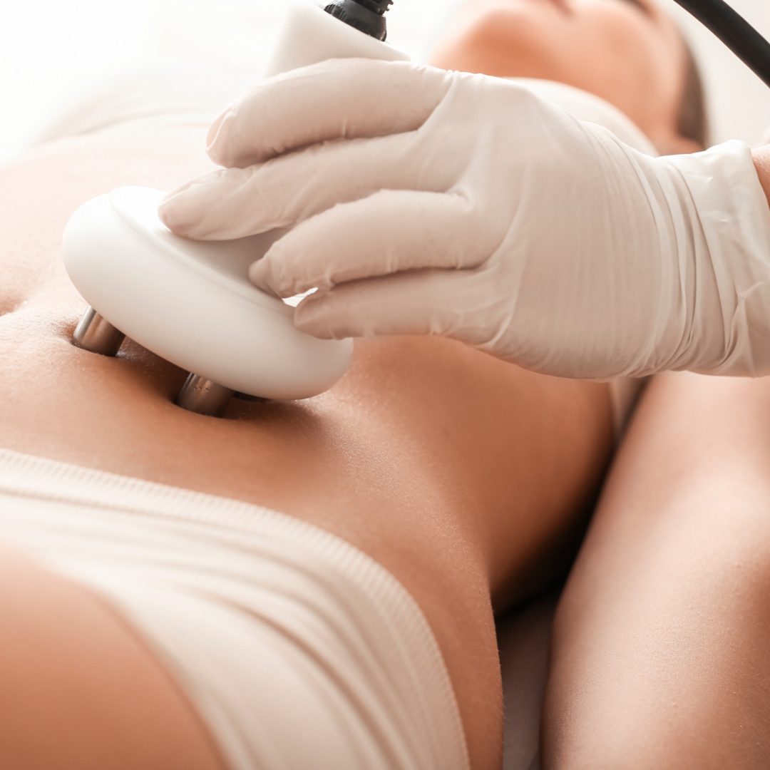 Beauty And Bella Body Contouring - Image 2